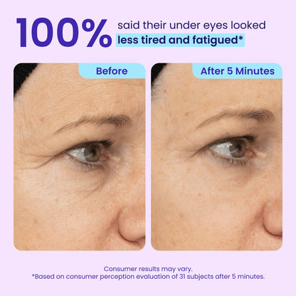 Lunarelle™ Instant Lift Eye Gel