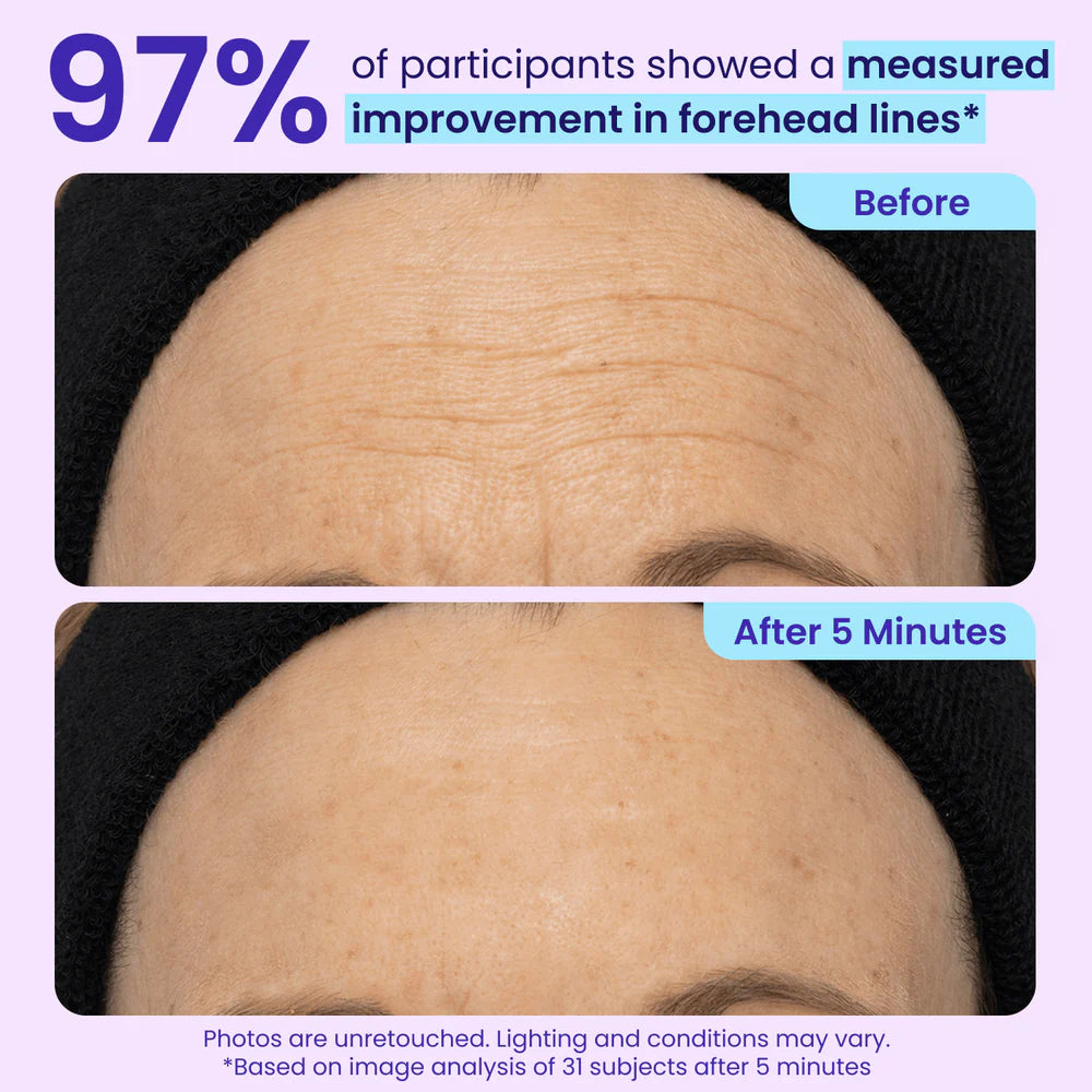 Lunarelle™ Instant Lift Eye Gel