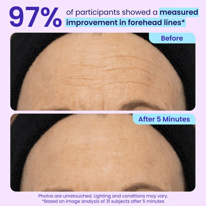 Lunarelle™ Instant Lift Eye Gel