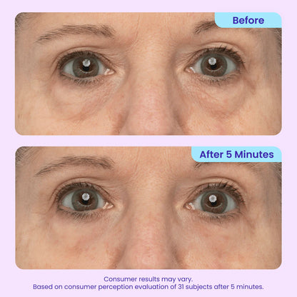 Lunarelle™ Instant Lift Eye Gel